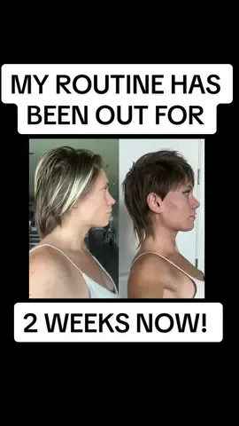 And its only been 2 weeks ♥️🥹 i am amazed and full of gratitude and joy for how many of yall have gotten the routine + already have visible results! 🙌🏼 one day at a time we are reclaiming whats rightfully ours 🥳 #beforeandafter  #15minuteposturedemo #mysticalpostureroutine #mysticalposturedemo #15minutepostureroutine #mysticalposturedemo #themysticalpostureroutine #dowagershump #neckhump #posturecorrection #posturehealth #forwardheadtilt #neckpain #neckhumpremoval #neckhumpfix #neckhumpcorrection #posturefix #coreexercise #wideribcage #backpainrelief #backstrength  #mysticalmckay #mysticalyogimckay #themysticalexperience #doublechin #turkeyneck #forwardheadposture #fhp #fht 