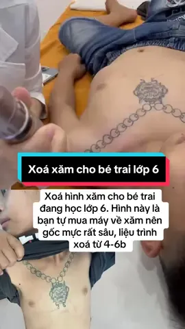 Nhìn vừa thương vừa buồn cười. Bé tự mua máy về tự xăm, không thèm ủ tê luôn 😱 #depcungsohee #07trannhatduat #dalieuthammy #xoaxam 