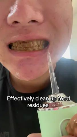 Very useful product #tiktok #foryou #tiktokshop #video #amazonfinds #goodthing #uk #fyp #waterflosser #tooth 