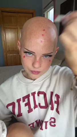 This was my beach makeup yesterdayyy 🤪 @ColourPop Cosmetics this blush is making me feel really sunkissed 💋☀️ ALSO, remember this is not about/or true for all Alopecia people, I just have not had hair since I was one years old and the longer you have it the more permanent the side effects are!!! so therefore no I do not get acne because I don’t produce oil very well due to the auto immune disease!!! This is from personal experience and everyone’s experience with Alopecia is different. Remember that!!! ❤️❤️❤️🫶🏻 ##alopeciaawareness##alopecia