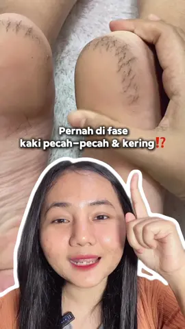 Yuk jaga & rawat kaki kamu dari sekarang dengan rutin pakai Foot Exfoliating Lotion dari @PREPARE.ID  #prepareindonesia #prepare.id #footcare #penghilangbaukaki #tumitpecahpecah #obatkakikapalan 