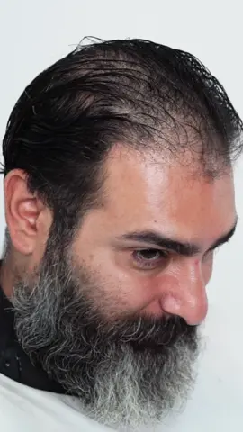 🌟 Unleash Your Hair’s Full Potential with THICK FIBER!  Tired of dealing with thin, lifeless hair? Look no further! Experience the incredible transformation that THICK FIBER offers today! 💆‍♀️✨ Say farewell to flat, lackluster locks, and welcome the newfound confidence of voluminous, luscious hair! 🙌 Available @amazon  Don’t let your hair hold you back any longer - try THICK FIBER now and witness the instant boost! 💫 Embrace the beauty of thick, full hair and rock any style you desire! 💁‍♀️ #HairConfidenceBoost #HairGoalsAchieved #VoluminousVibes #HairThickeningSolution #HairGameChanger #FullnessOnFleek #HairTransformationJourney #HairFiberPower #ConfidentHairDay #HairVolumeEnhancer #thickerhair #HairThickeningSecrets #thickfiber #amazonfinds #VollesHaar #hairfibres #hairfiber  #Haarzauber #haarstärken 