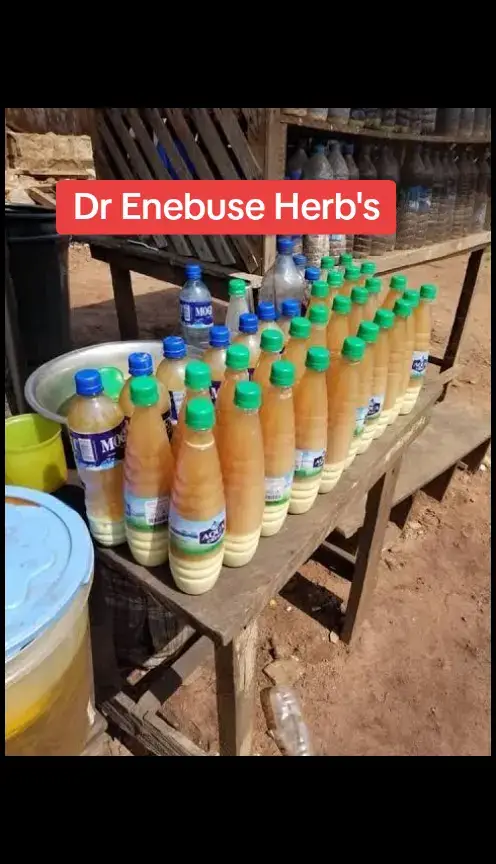 #lupusflare #lupuswarrior #lupusawareness #lupusstruggles#lupussucks #lupuslife #symptomsoflupus #justafew #butterflyrash #skinlesions #lupus #AXERatioChallenge #fy #autoimmunedisease#automimmunediseasewarrior#fightingautoimmnunedisease#justraisingawareness #flareups