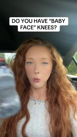 I AM NAMING THEM GERT AND LINDA #babyfaceknees #knee #knees #kneecap #imscared #weird #weirdbodyparts #bodyparts 