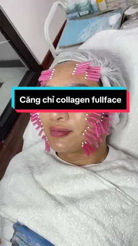 Căng chỉ collagen trẻ hoá, săn chắc da. Mỗi năm một lần để cùng nhau lão hoá ngược chứ nhỉ 🥰🥰🥰🥰 #bacsidalieu #dalieu #thammynoikhoa #cangchicollagen #fakesituation #fakesituation⚠️ #fakebody⚠️ #drskinacademy 