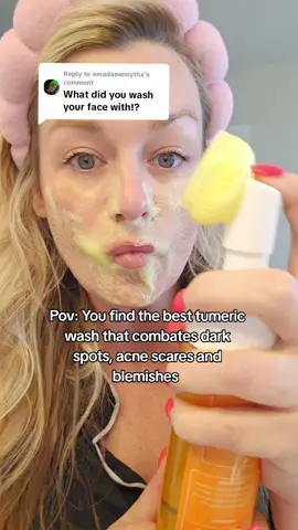 I love this cleanser! It makes my face feel so soft and clean! #sundamagedskin #sundamagetipsk  #darkspottreatment #darkspotsonface #darkspotsolution #acnetreatment #exfoliatingpads #tumeric #creatorsearchinsights #skin #skincare #skincareroutine #kojicacid #exfoliate #viralproducts #viralskincare #kojicacid