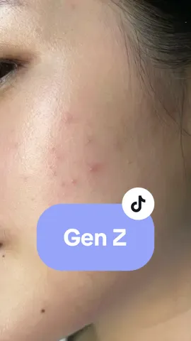 blm gen z ni klo blm pke ini 😏 #Retinolviral #Moisturizerviral #Retinoid #Retinol
