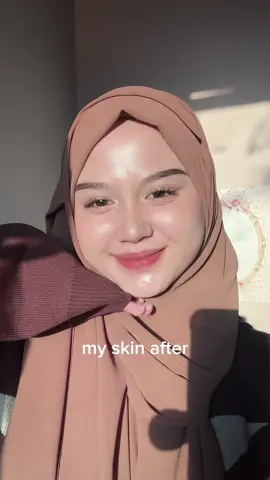 sempet ga pede makeupan karna wajah aku bertekstur 💔