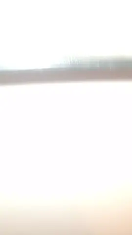 Thats my f*cking shoulder 😔 #thedeep #thepeak #shoulder  #teamwork #xycbza #fyp 