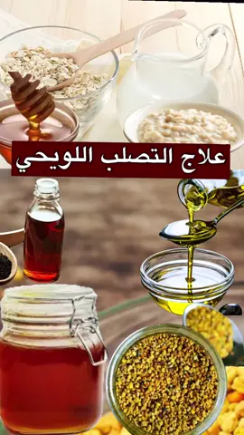 #التصلب_الويحي #الشوفان #الحليب #العسل #حبوب_القاح #غذاء_الملكات  #بندر_بن_علیان #الدعاء  #الاعشاب #علاجات  #الصدقة #اكسبور_erolpxe  #اكسبلورexplore  #اكسبلور #ترندات_جديدة  #مشاهیر_تيك_توك_العرب  #ترندات_تيك_توك  #الهاشتاقات_للرخوم #الرخوم #الصين_ماله_حل #الصين_ماله_حل😂  #ترند_السعودية #زد_رصيدك #البزنس  #مشاهير #مشاهير_تيك_توك  #فلولوو #الرياض #الدواء #دعاء #كررونا  #اكسبلور 