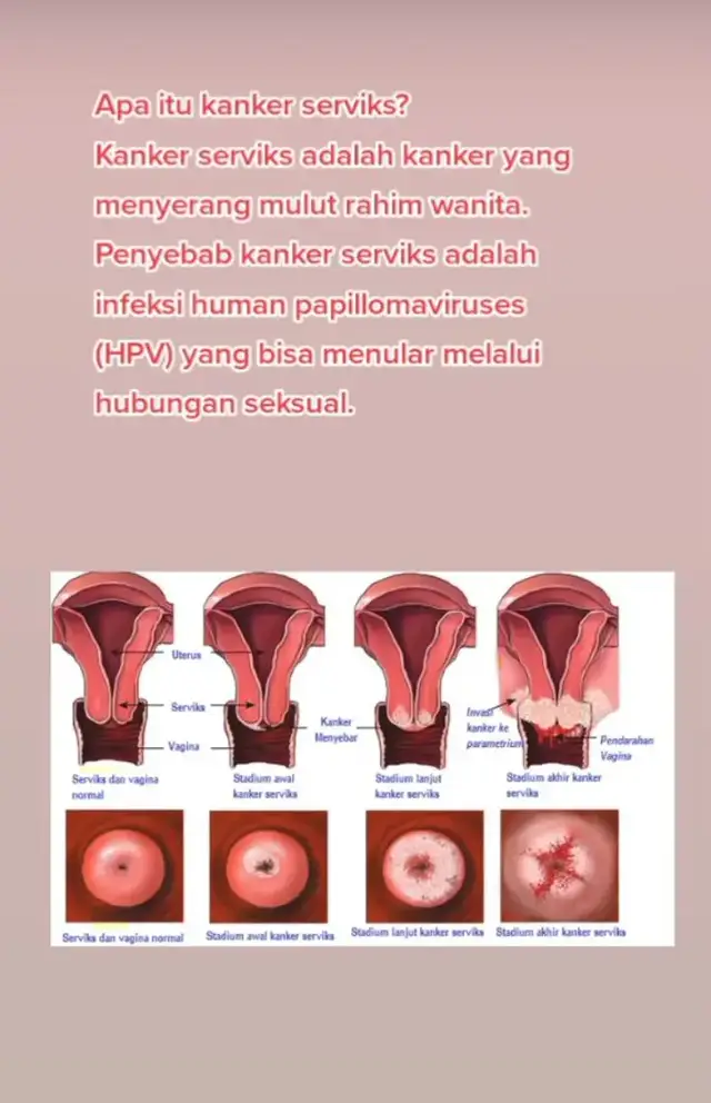 kenali gejalanya, bila sudah terdeteksi segera lakukanlah pengobatannya segera mungkin ya bunda-bunda👆#pejuanggarisdua #edukadipromil#konsultasidokter #berhasilhamil 