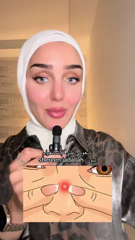 جل إيبيديو بعالج حب الشباب  المكونين الفعالين بيروكسيد البينزويل بنظف المسام وبمنع ظهور الحب والادابالين بمنع تورم والاتهاب وبمنع إنتشار الحبة  لا يستخدم للمرضعة والحامل  ولا يستخدم على الجروح  #skincareroutine #skincare 