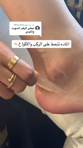 الرد على @Nono Zbxk #اكسبلورexplore #foryou #اكسبلور_تيك_توك #عشبه_وزيت #تقشير #عنايه #اكسبلور؟ 