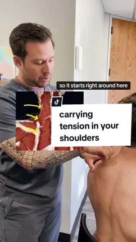 If you feel like you carry your tension in your shoulders: this one is for you  The problem could be an unhealthy SA nerve  #Adhesion often builds up and irritates nerves when there is trauma or repetitive motion in the area But Dr. Chris is one of the only doctors in Illinois who is specifically trained to find and fight adhesion WITHOUT surgery  Hit us up to use the most holistic method of relieving pain long-term