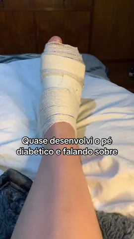 Quase fiquei sem meu dedinho😵 #diabetica #diabetes #diabetestype1 #diabetic 