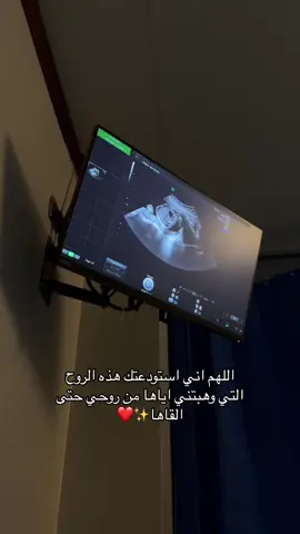 يارب يسرلي ماتبقى من حملي❤️ #اكسبلور #جنين #حمل #ولادة #بشاره_مولود #امومة #طفلي #explore #fyp 