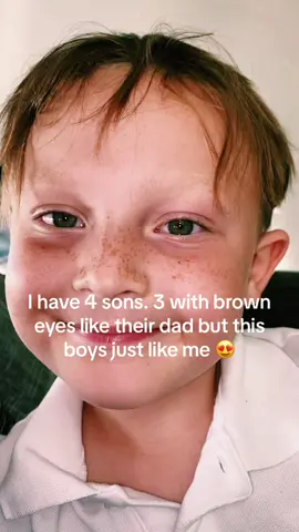 PRETTY GREEN EYES 💚 #greeneyes #green #eyes #son #rare #freckles #justlikeme #boy #fyp