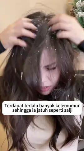 Sea salt anti-dandruff shampoo 🧴#shampoo #antidandffshpoo #dandruff #relieveitching 