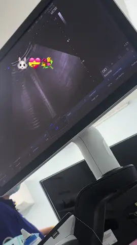 อีก 4 เดือนก็จะได้เจอกันแย้วน้าเจ้าตัวน้อย เด็กน้อยที่ฉันอยากเจอมากที่สุด💝👶🏻 #เจ้าตัวน้อยของแม่👶🏻💝 #ทีมพฤศจิกายน #ปีมังกรทอง67 #21w1d 