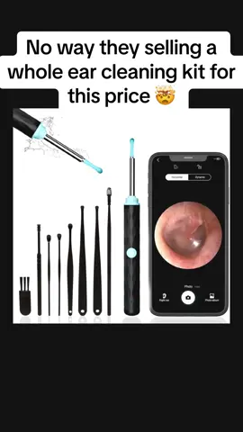 #earwax #earwaxremoval #earcleaning #asmr #fyp #CapCut 