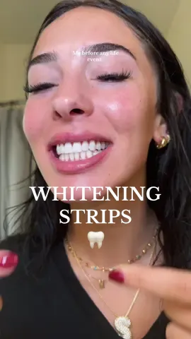 Been slacking lately but just got a new box of my whitening strips🤩 CONSISTENTCY IS KEY 🤍 #whiteteeth #teethwhitening #oralcare #gurunanda #whiteningstrips #foryoupage 