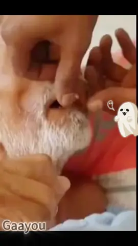 Do you know about tonsil stones? 😱😨#tonsilstones #badbreath #oralhealth #oralcare 