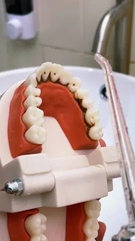 I’ll use it after eating 🦷#healthysmile #waterflosser #dentalcare #oralcare #teethwhitening #portable #dentalirrigator #foryou #freshbreath #gumhealthy 