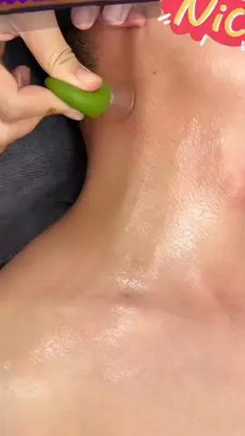 Giác hơi nhỏ dễ dàng giác ở khắp mọi nơi trên cơ thể, hút hàn khí, hàn độc... #giachoi #viral #tiktok #xuhuong2024 