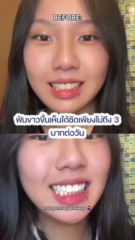 เจอผลิตภัณฑ์ฟอกฟันขาวที่ดีมาก #mysmile #teethwhitening #เซรั่มฟันขาว #ยาสีฟันฟันขาว #ฟันขาว #ฟันขาวเป็นธรรมชาติ