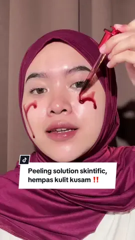 dari kemarin lewat terus ni produk 😩 skintific emang ga ada capeknya yaa?! ini salah-satu produk mereka yang aku naksir parah sama hasilnya!! defisini produk eksfoliasi yang hempas sel kulit mati, bye kulit kusam 😎 #eksfoliasi #peelingsolution #fyp 