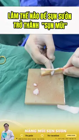 Điêu khắc sụn sườn là một kỹ thuật nâng mũi tiên tiến sử dụng sụn từ xương sườn của chính cơ thể người. Đây là phương pháp lý tưởng cho những ai mong muốn có dáng mũi cao, thanh thoát mà vẫn tự nhiên và an toàn. Điêu khắc sụn sườn là một kỹ thuật nâng mũi tiên tiến sử dụng sụn từ xương sườn của chính cơ thể người. Đây là phương pháp lý tưởng cho những ai mong muốn có dáng mũi cao, thanh thoát mà vẫn tự nhiên và an toàn. Bởi sử dụng sụn tự thân, phương pháp này giúp giảm thiểu nguy cơ phản ứng dị ứng hoặc từ chối vật liệu cấy ghép, đồng thời đảm bảo độ bền lâu dài cho kết quả thẩm mỹ. Điêu khắc sụn sườn không chỉ cải thiện hình dáng mũi mà còn mang lại sự tự tin và nét đẹp hài hòa cho khuôn mặt.#nangmuisunsuon #nangmuidanang 🏥 299 Dương Đình Nghệ, P. An Hải Bắc, Q. Sơn Trà, Tp. Đà Nẵng 🌎 https://drharvard.vn ☎️ 093 185 85 79 - 091 412 54 79 #bacsyvinhnhan #drharvard #hocnghethammy