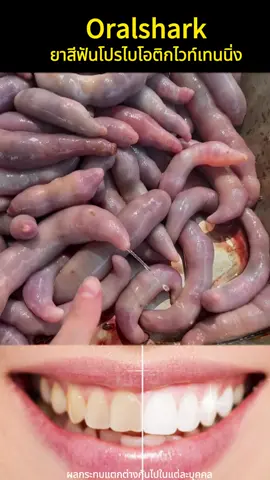 คู่หูที่สมบูรณ์แบบสำหรับการแต่งหน้า ยาสีฟันไวท์เทนนิ่งนี้ทำให้คุณมั่นใจมากขึ้น#canban26.7.4