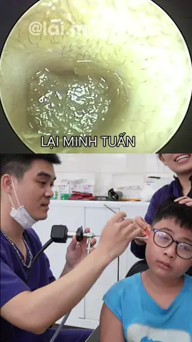 tại sao cứ phải kéo vành tai mới nghe rõ được #xuhuong #xuhuongtiktok #laiminhtuan #layraytaicocamera #layraytaicucphe #layraytaichuanykhoa #layraytaichobe