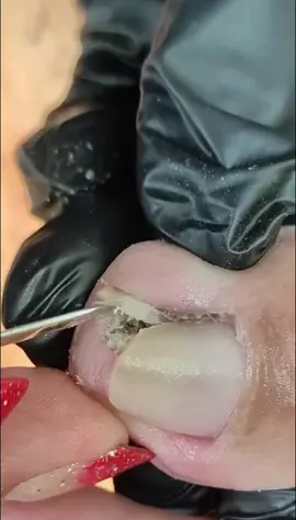 Lấy khoé siêu phê #laykhoe #nails #nail #laykhoemong #laykhoemongchan #laykhoechan #taovamich 