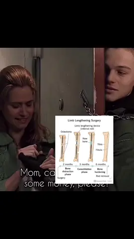 #pslharvy #hardmaxx #mogged #looksmaxxin #lookism #blackpilledagain 