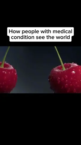 how people with medical condition see the world😯😯😯#meme #aviation #avgeeks #avgeeksoftiktok #plen #boeing777 #boeing 