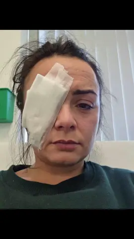 Found these whilst scrolling for something else. I'll never forget that morning, waking up with complete paralysis to my left side. As a girl in my 20's, I thought life was over. I thought I'd be stuck with paralysis and wonky face for the rest of my life. Looking back on these, not only did I come out the other end with no permanent paralysis, but I can also look back at how I started to embrace my new look and my confidence started to grow again.  Not matter how bad things are, don't stop smiling - there's always someone a lot worse off and we should be forever grateful for what we do have 🫶 . . . #fyp #foryou #bellspalsy #facialparalysis 