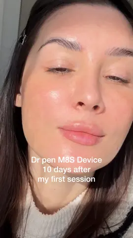 It’s been almost 2 weeks after my first in home microneedling session with the M8S Dr pen microneedling device, and omg, I literally have no words, the glow is real 🤩 my pores look way smaller and my texture improved so much 🤩 I cannot wait to do my second session! I was scared at first 😂 but it took me all but 2 seconds to realize how user friendly this pen is 😎 it’s unreal 😍 I’ll take doing this myself ah home than in clinic ANY day 🤩 super super recommend, a true investment on your skin 😍🥰  @Dr. Pen Global   #skincare #skincaretips #microneedling #drpen #skintexture #acneskin #texturedskin #skintighening #skintreatment #pigmentation #skintok 