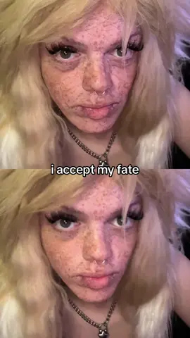 age filter | 0 : Cortisa | 100