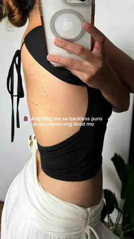 If nakaka experience ka din ng back acne at chest acne, worth it na i-try to mga beh.  #acnecarebacnebodywash #chestacne #fyp #foryoupage 