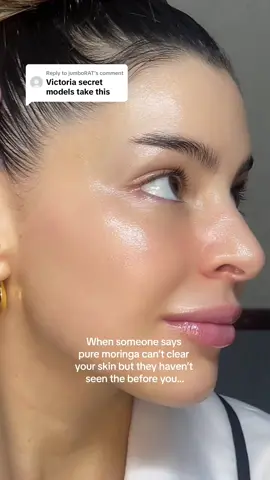Replying to @jumboRAT my baby 🥹🤍 #supplementsforwomen #wellnesstips #naturalbeautytips #skincaregirl #howtogetclearskin #beautytips #hotgirlsupplements #thatgirl #puremoringa #acnebeforeandafter @thatgirlstore.com 