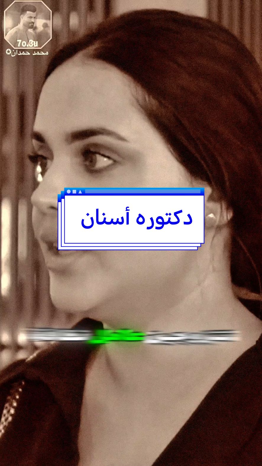 المهم الأخلاق طبيبة أسنان وما تمانع تتزوج عامل نظافة🙂 #ابوحشد_الفتلاوي #حسين_ال_طالب 