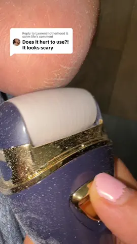 Replying to @Lauren|motherhood & sahm life #callusremoval #callusremover #electriccallusremover #feetcare #fy #tiktokshopfinds #tiktokmademebuyit 