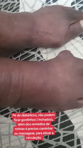 Pé de diabeticos!