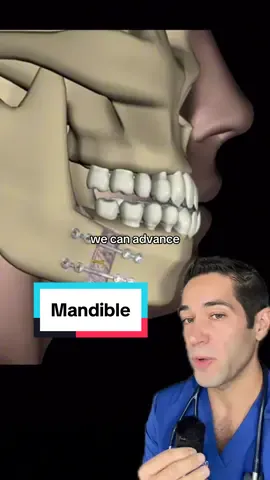 #mandible #shortchin #chin #surgery #omfs #dental  