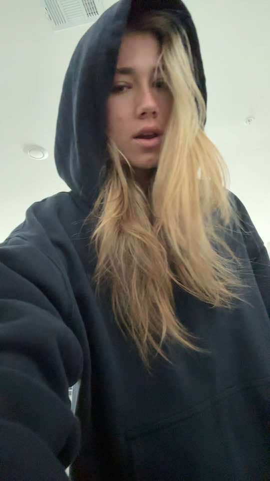 Do yall pop ur pimples lmk #draft 