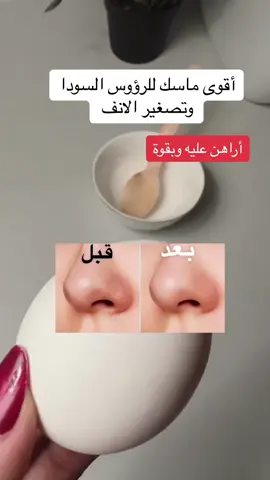 بنات مين جربته ؟ #fyp #fypシ゚viral #اكسبلووووورررر 
