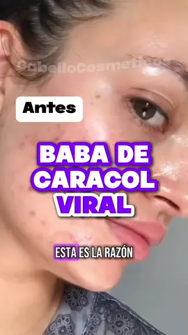 SKIN CARE LLEGÓ A CABELLO COSMÉTICOS 💆‍♀️✨ Conoce COSRX 💚 💚 Esencia Facial Avanzada de Caracol 96% : LA MÁS VIRAL 🤩 Está creada a partir de mucina de caracol filtrada para desvanecer las manchas, mejorar la textura de la piel $17 (100ml) 💚 Crema Facial Avanzada de Caracol 92% TODO EN 1: Crema en gel se absorbe instantáneamente en la piel, proporcionándole una completa nutrición y Antienvejecimiento. $16 (100g) Todo Disponible en Cabello Cosméticos 💜 📍SAMBIL CHACAO: Tenemos Stand Físico en Plaza Central, nivel autopista, al lado de las escaleras mecánicas (Stand Blanco con Morado💜) 📍SAMBIL LA CANDELARIA: Nivel Andrés Bello (Planta Baja), en el pasillo central que conecta los dos lados de la avenida  Horario: 10am - 9pm💜✨ 🛵 Contamos con delivery en TODA Caracas por un costo adicional de 3$💖 PROMOCIÓN: SI TU PEDIDO ES MAYOR A 40$ EL DELIVERY ES GRATIS 🥰❤️ #cosrx #cosrxcaracas #cosrxvzla #cosrxvenezuela #cosrxccs #skincare #skincarevzla #skincarevenezuela #skincarecaracas #skincareccs #tipsskincare #tipscuidadofacial #cuidadofacial 