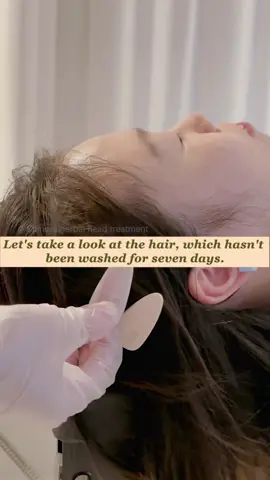 Hurry up and slide away! Otherwise, this will be the last video you watched tonight.  #relax #relieve #massage #dandrufftreatment #scalpcare #headspa #washhair #foryou #spa #asmr #treatments #relievepressure #asleep #relaxingasmr #headmassage #therapy #massagetherapy #sleep 