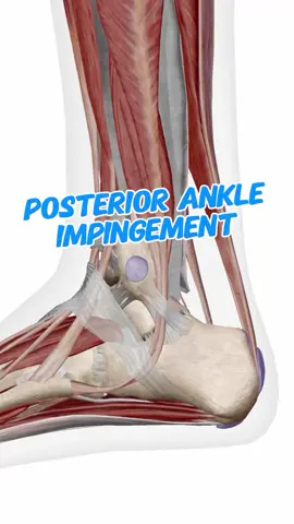 🦶Posterior ankle impingement: what is it & how to diagnose it? Posterior ankle impingement is an important differential for posterior ankle pain, that we see frequently misdiagnosed as Achilles tendinopathy. 🦶This condition involves the compression of structures in the back of the ankle and can be caused by joint, bone or soft tissue issues. 🤕 Symptoms tend to be aggravated by end-range plantarflexion movements such as raising up on tiptoes or kicking a ball.  🔎 The Posterior impingement test will also be positive for pain in the back of the ankle.  👋Like & save this if you learnt something! . . . . #anklepain #heelpain #achillespain #achillestendinopathy #runninginjury #chiro #sportschiro #chiropractic #physiotherapry #physicaltherapy #sportsphysio #podiatry #osteopathy